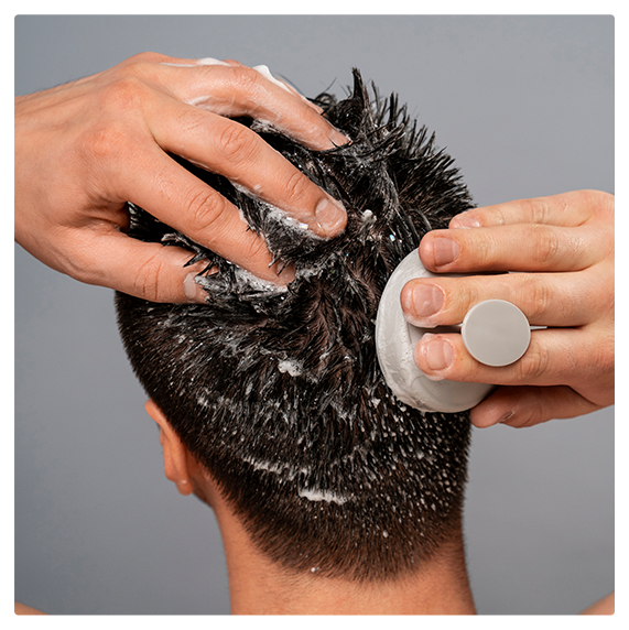 Treating Dandruff